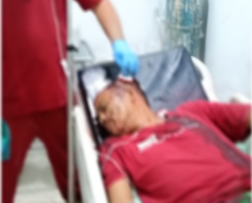 Diduga Ada Dendam Pribadi, Seorang Supir Dibacok Dibagian Kepala, Kini Pelaku DPO !!!